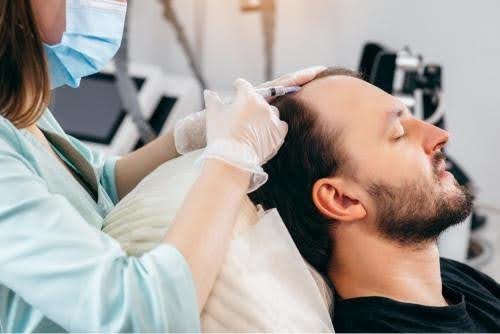is hair transplant permanent